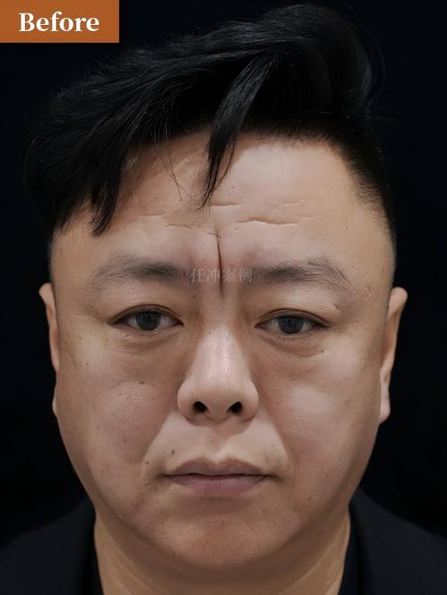 民保24小时在线套医保微信能用吗怎么弄？官方解答来了